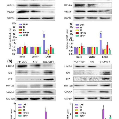 A Overexpression Of Lkb But Low Expression Of E E Hif And