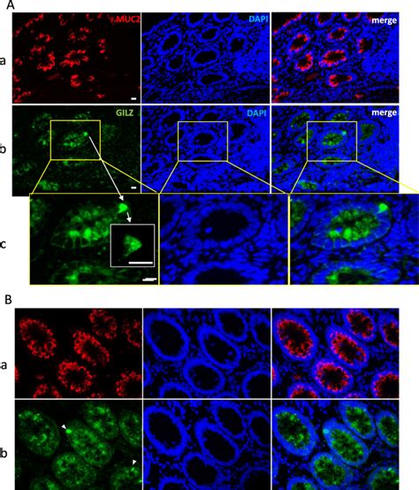 A Immunofluorescence Staining Of Gilz And Muc In Representative