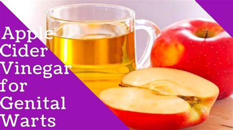 Apple Cider Vinegar For Genital Wartsapple Cider Vinegar Warts Remedy