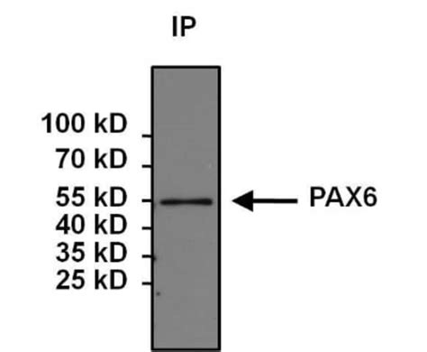 Pax6 Antibody 01mg Unlabeledantibodies Polyclonal Fisher Scientific