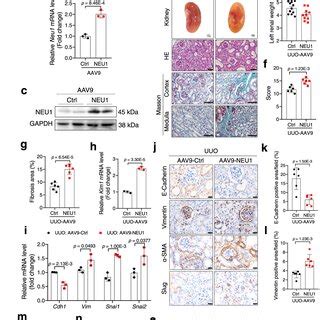 NEU1 Overexpression Aggravates UUO Induced Renal Fibrosis A Schematic