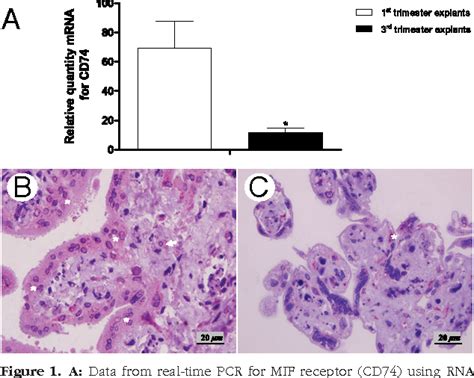 Figure 1 From Immunopathology And Infectious Diseases Effect Of