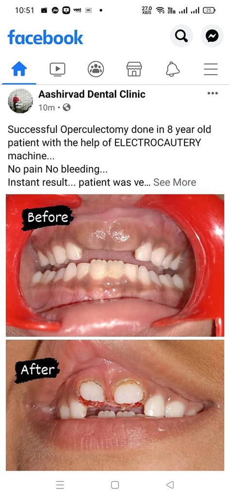 Aashirwad Dental Clinic Nadiad