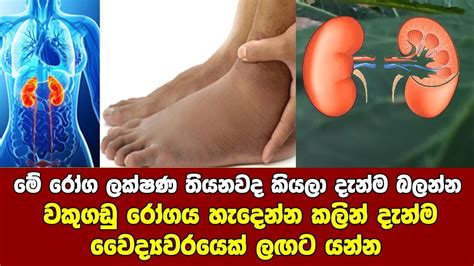 මේ රෝග ලක්ෂණ තියනවානම් ඔබටත් වකුගඩු රෝගය වෙන්න පුලුවන් Youtube