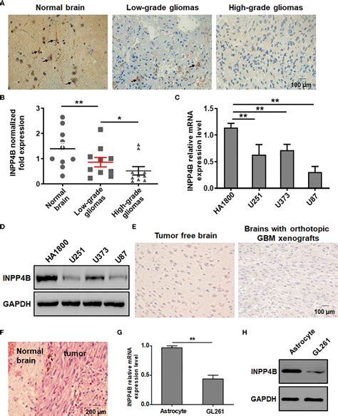 Frontiers Inpp4b Inhibits Glioma Cell Proliferation And Immune Escape