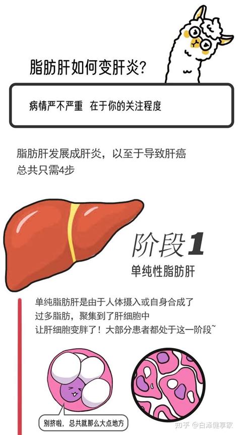 脂肪肝是如何变成肝炎的？可逆转吗？ 知乎