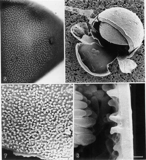 Ascosphaera acerosa. DAOM 216565, type isolate. 5. Wall of ascoma in ...