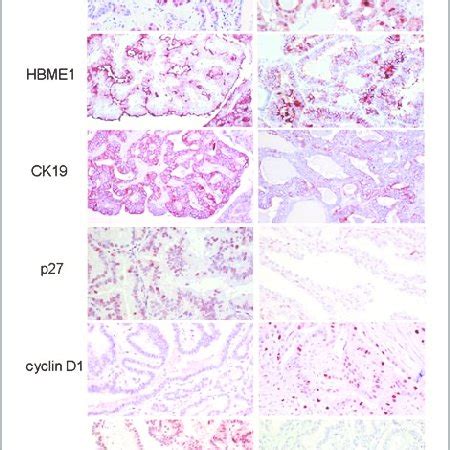 Representative photomicrographs of the immunohistochemical markers ... 