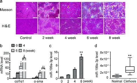 Increased Mir 199a 3p Expression In Fibrotic Liver Tissues From Rat