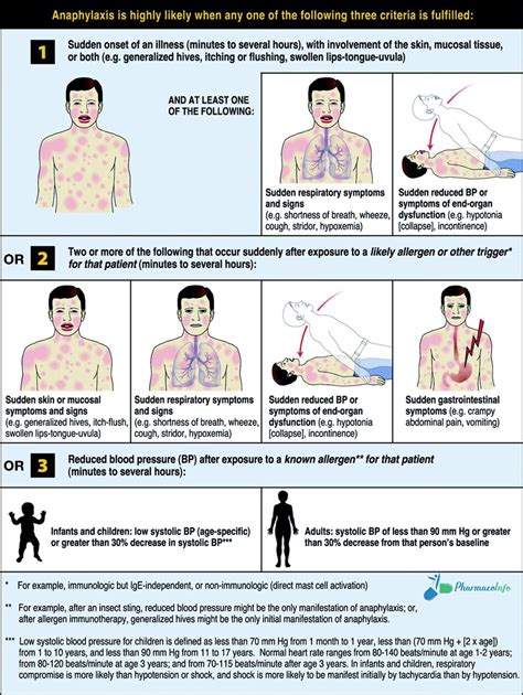 Anaphylaxis Overview Definition Criteria Of Diagnosis Summary Of