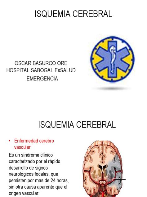 Isquemia Cerebral | Isquemia | Ct Scan