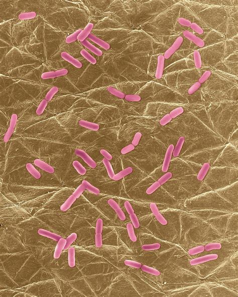 E Coli On Human Skin Surface Photograph By Dennis Kunkel Microscopyscience Photo Library