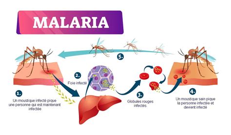 Malaria Symptoms Treatment Can It Be Cured