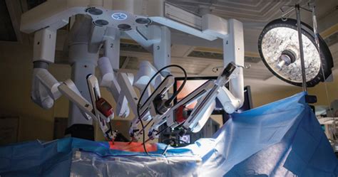 Liability In Robotic Gyn Surgery Mdedge Obgyn