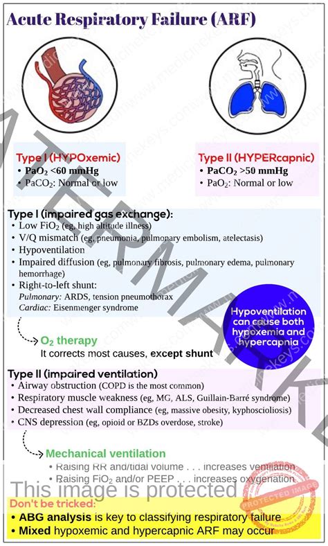 Acute Respiratory Failure Arf Medicine Keys For Mrcps