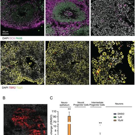 Gsk Inhibition By Chir Affects Neuronal Differentiation Of