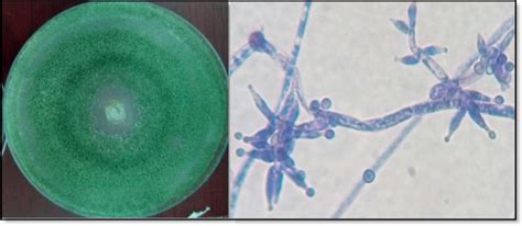 Macroscopic And Microscopic Appearance Of Trichoderma Isolate T After