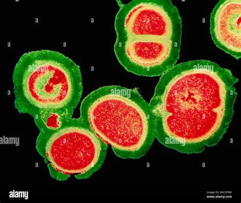 Mrsa Resistant Staphylococcus Bacteria Coloured Transmission Electron