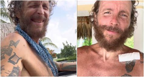 Jovanotti Tornato In Italia Dopo L Operazione A Santo Domingo