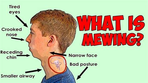 What Is Mewing How To Mew And How It Can Change Your Face Youtube