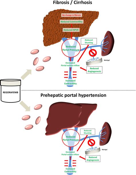 Regorafenib Mechanism Of Action