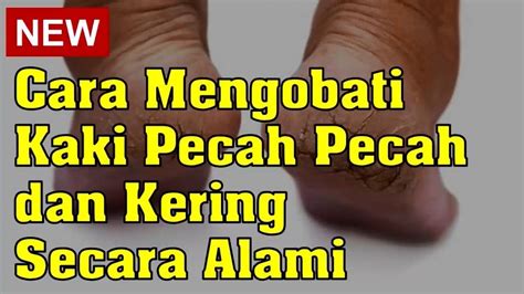 Cara Mengobati Kaki Pecah Pecah Dan Kering Secara Alami Youtube