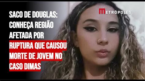 Saco De Douglas Conhe A Regi O Afetada Por Ruptura Que Causou Morte De