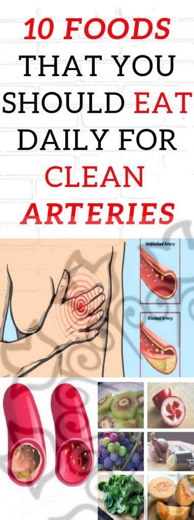 How Long Can You Live With Blocked Carotid Artery Be Such A Good