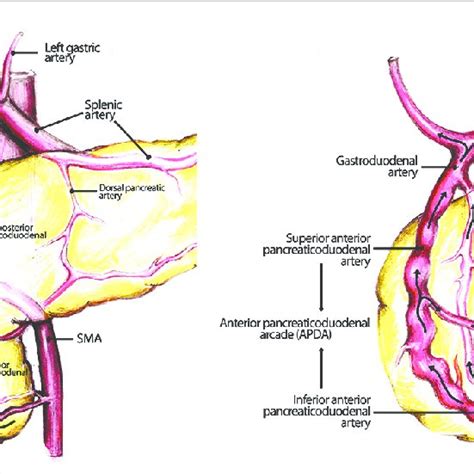 (PDF) Prominent gastroduodenal artery: Endosonographic sign of celiac ...