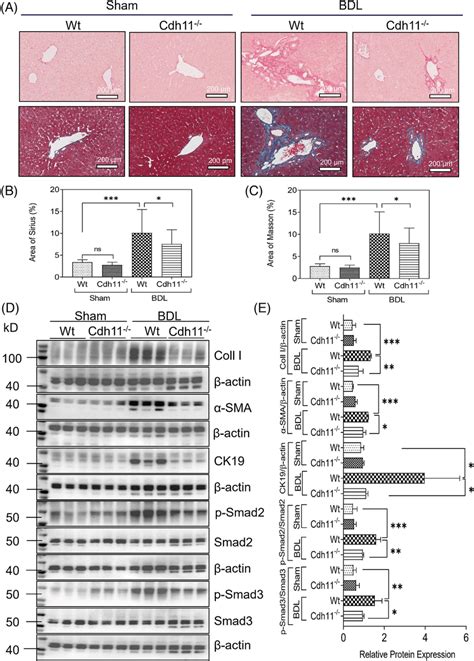 Cdh11 Knockout Suppressed BDL Induced Liver Fibrosis In Mice A