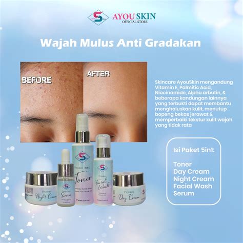 Jual Ayouskin Skincare Untuk Meratakan Tekstur Kulit Wajah Kasar Tidak