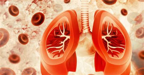 Pulmonary Hemorrhage Nurses Revision