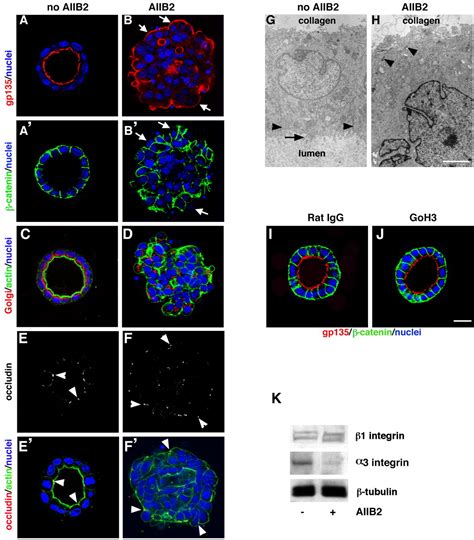 β1 Integrin Orients Epithelial Polarity Via Rac1 And Laminin