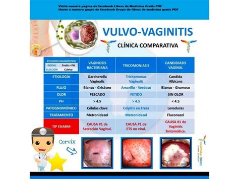 Res Menes De Flujo Vaginal Descarga Apuntes De Flujo Vaginal