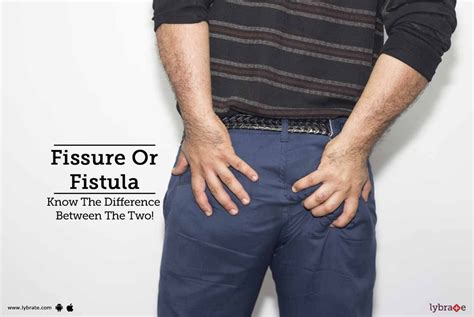 Fissure Or Fistula - Know The Difference Between The Two! - By Dr. Rahul Jawahar | Lybrate