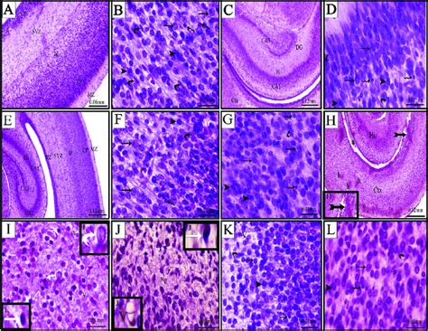 Photomicrographs Of Cross Sections Passing Through The Cerebral Cortex