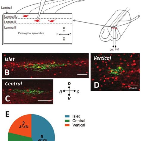 Morphologic Features Of Gad2 TdTomato Labeled Neurons In Parasagittal