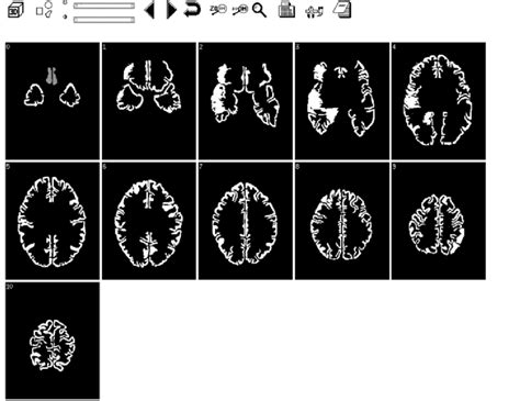 The Map Of Brodmann Areas Appears While The Able Is Determining Which