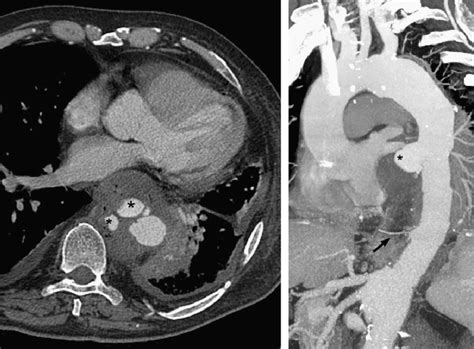 Axial And Multiplanar Scans Of Preoperative Computed Tomography Download Scientific Diagram