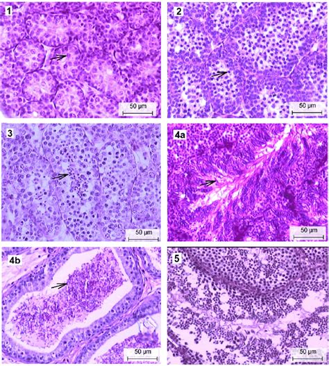 Selected Pictures To Illustrate The Spermatogenic Stages Found In