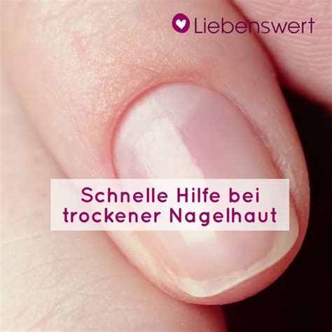 Aktuell Suche prüfen trockene nagelhaut Schlummern Delle Einblick