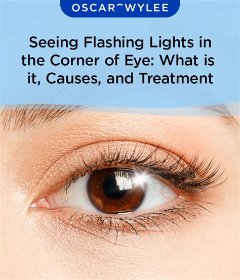 Seeing Flashing Lights In The Corner Of Eye What Is It Causes And