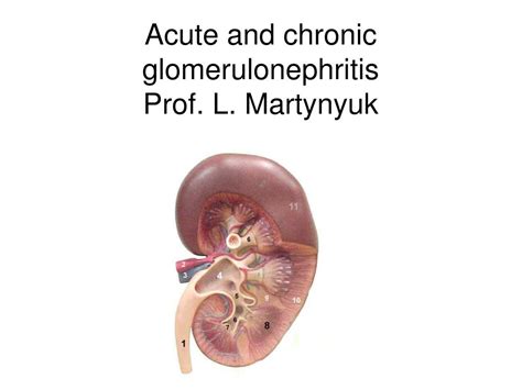 Chronic Glomerulonephritis Pictures