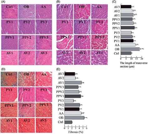 FVs Attenuate Cardiac Histological Abnormalities Hypertrophy And