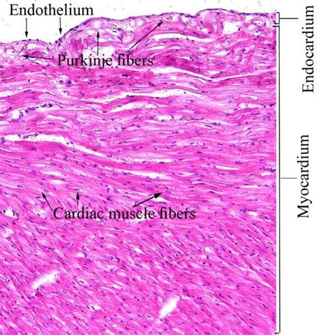 Section Through The Wall Of The Heart Showing The Endocardium And