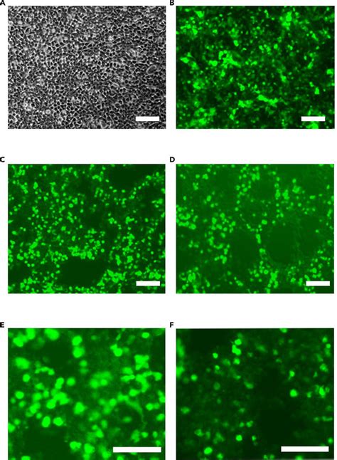 Lentivirus Preparation And Titration A Hek Cells At Transfection With