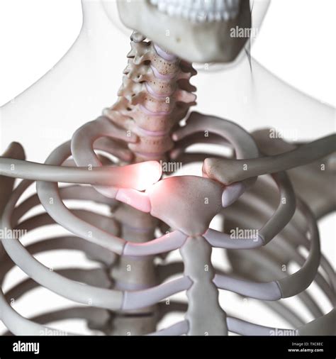 Sternoclavicular High Resolution Stock Photography And Images Alamy