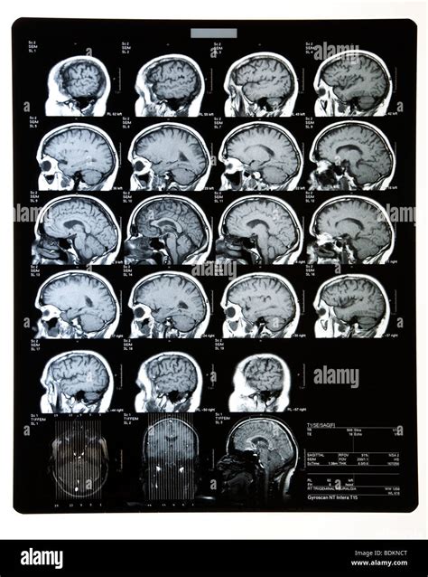 Scanner C R Bral Banque De Photographies Et Dimages Haute R Solution