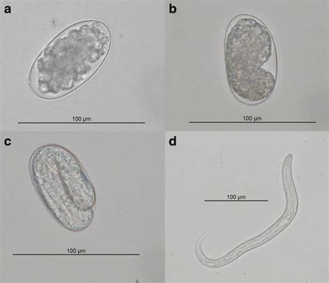 Nematodes Trematodes Cestodes Flashcards Quizlet