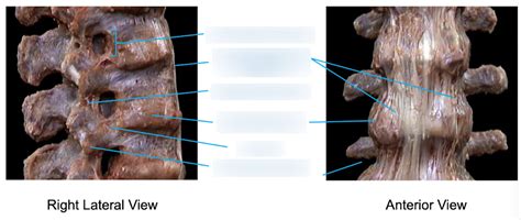 Vertebral Joints And Ligaments Right Lateral And Anterior View Diagram